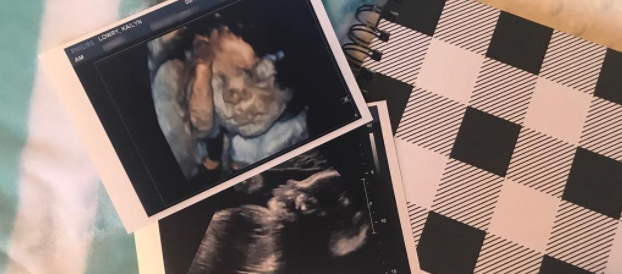 Super Fans Have Guessed the Gender of Kailyn’s Baby!
